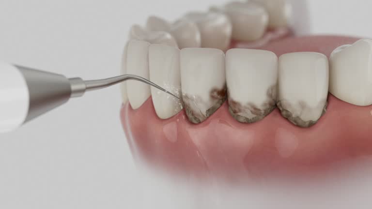 Reliable Dental contractor in Eatonville, WA by Dentist Open Now